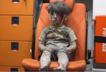 Siri, video e pesëvjeçarit të mbuluar me gjak përshkon botën