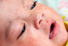 Fruthi rikthehet frikshëm në Europë