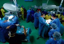 Kirurgët ndajnë binjaket/ 3 vjeçaret ishin të bashkuar në kokë