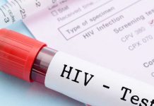 Rritet numri i rasteve me HIV në Kosovë, 19 për shtatë muaj