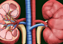 A shkaktohen gurët në veshka nga ushqimet? Ja çfarë thotë shkenca