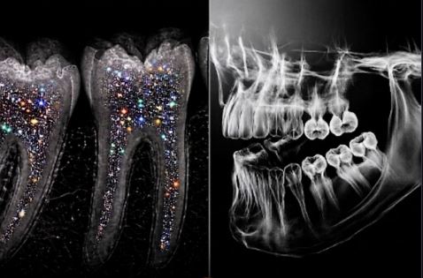 teeth